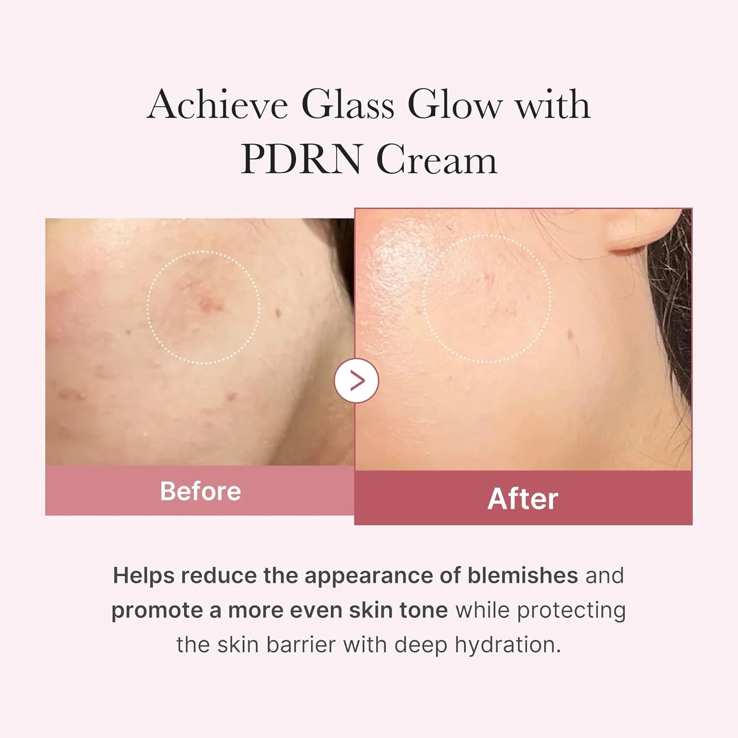 Medicube – Crema Hidratante PDRN Pink con Ácido Hialurónico 50ml – Regeneración y Luminosidad www.sallunabeauty.com