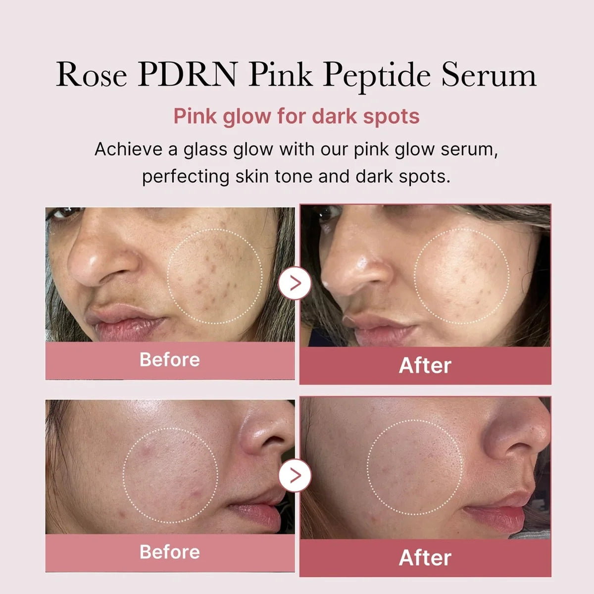 Medicube – PDRN Pink Glutathione Serum Mist | Bruma Iluminadora & Reparadora · Antioxidante 100ml www.sallunabeauty.com