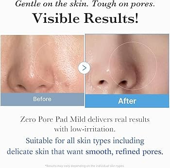 Medicube – Zero Pore Pad Mild (70 Piezas) | Exfoliación Suave para Poros & Piel Sensible www.sallunabeauty.com