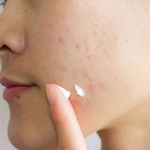 SKIN1004 Madagascar Centella Tea-Trica Spot Cream | Crema Calmante Anti-Imperfecciones (20 ml) www.sallunabeauty.com